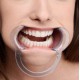 Baillon RETRACTOR Mouth