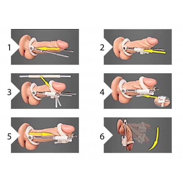 Estensore meccanico del pene Bianco