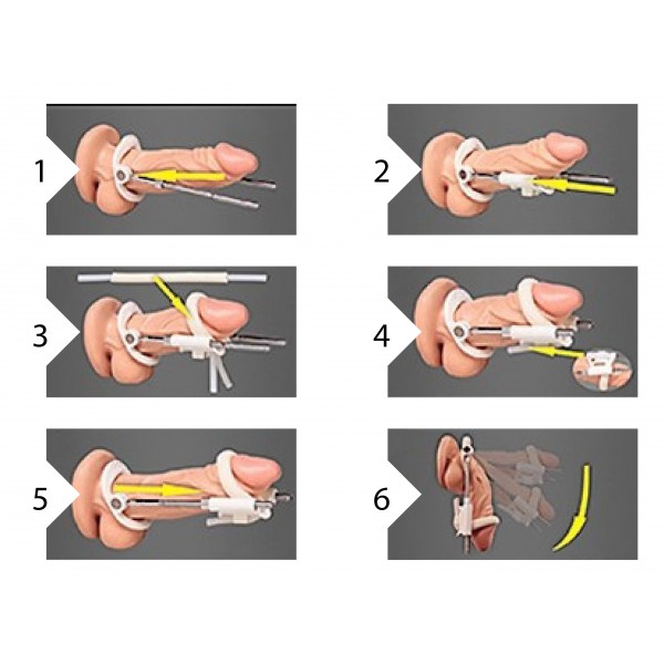 Extensor de pénis preto